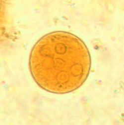 250_entamoeba_coli_iodine_bron_cdc.jpg