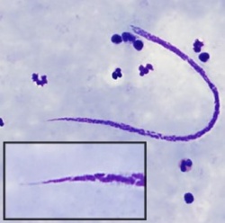 250_mansonella_broncdc.jpg