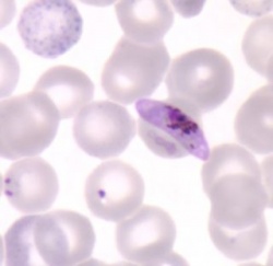 250_plasmodium_falciparum_gametocyt_trofo_bron_cdc.jpg